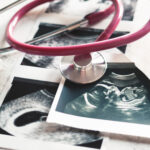 In the pictures of the ultrasound 4 weeks of pregnancy and 20 weeks is a phonendoscope. The concept of the study of pregnancy.