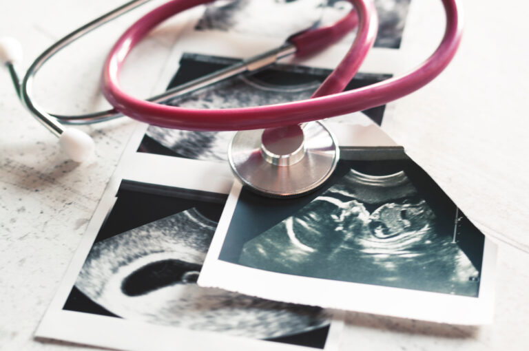 In the pictures of the ultrasound 4 weeks of pregnancy and 20 weeks is a phonendoscope. The concept of the study of pregnancy.