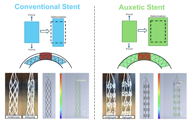 Figure 1. Comparison of conventional and auxetic stent retriever designs. (Top) Schematic describing the differences between positive (blue) and negative (green) Poisson’s ratio material. (Middle) Schematic depicting the behaviors of a conventional stent retriever with positive Poisson’s ratio (blue) and an auxetic stent retriever with a negative Poisson’s ratio (green) deployed within an artery and their degree of clot integration. (Bottom) Example 3D printed prototypes and computational simulations comparing conventional and auxetic stent retriever designs under tension.