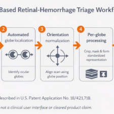 Detection of Retinal Hemorrhage on Head CT Using Deep Learning in Young Children