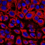 Controlled Release of Drug Cargo using ATP-Responsive Liposomes